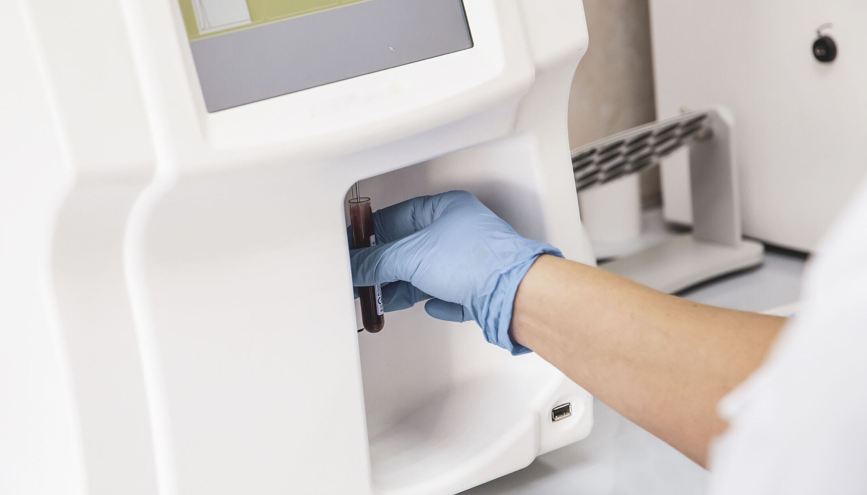 Person holding a test tube to a blood gas sensor